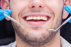 Affordable Dental implants Dental implants in Brisbane QLD